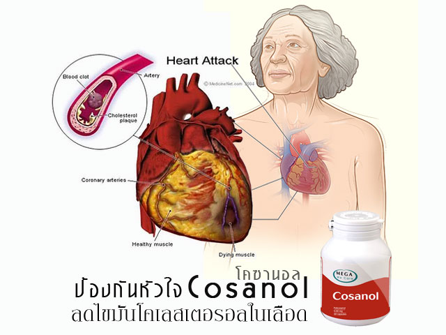 ลดไขมันโคเลสเตอรอล