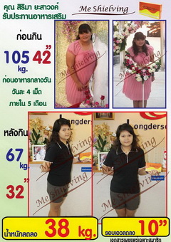 รูปร่างผอมเพรียว