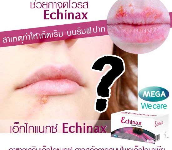 ECHINAX