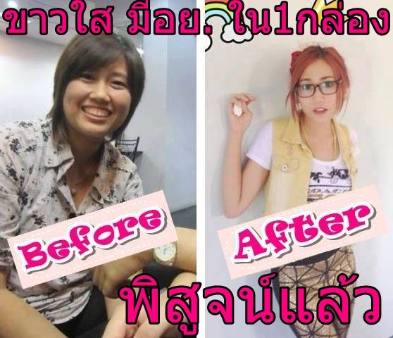 ขาวใสถาวร