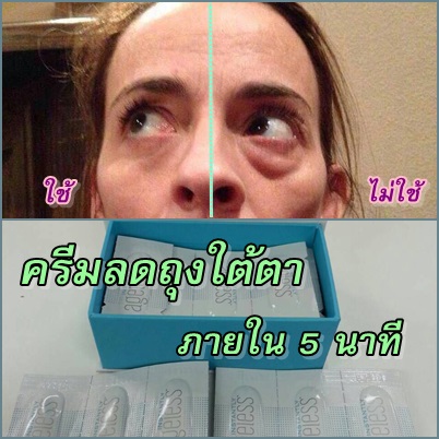 ครีมลดถุงใต้ตา